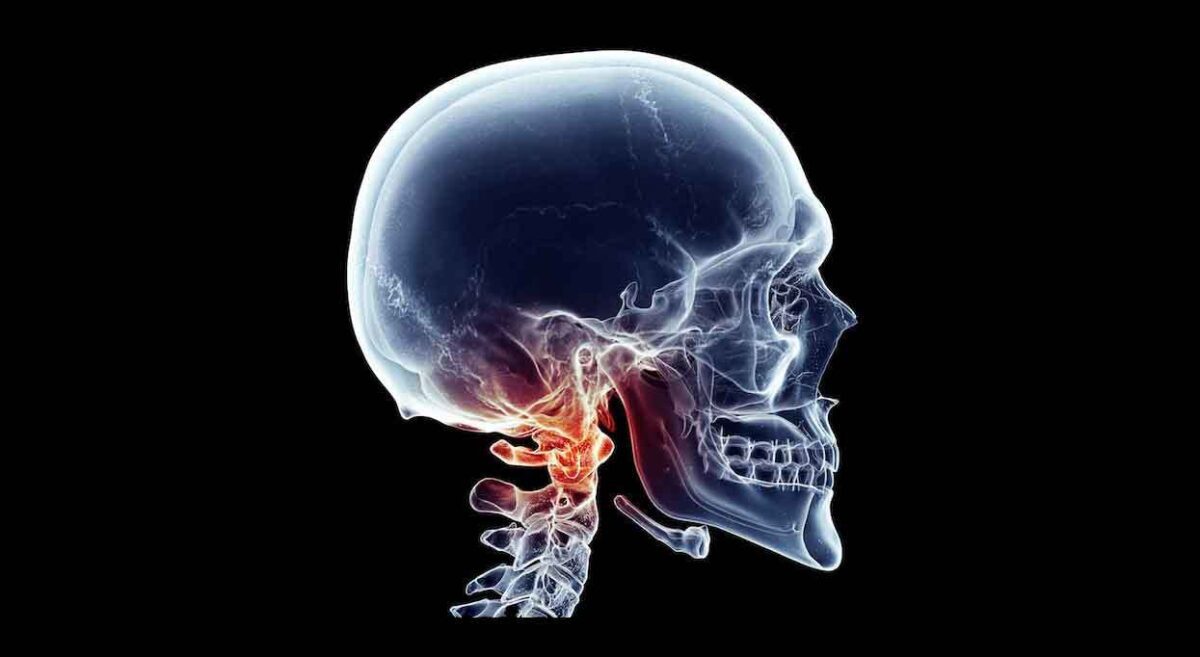 What Does Cbct Scan Show